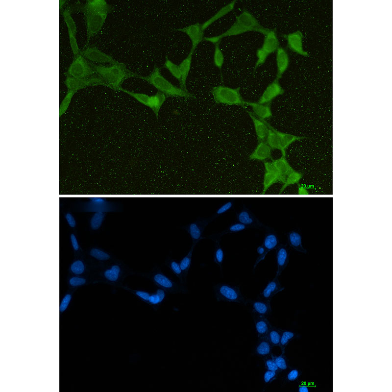 DDX21 Rabbit mAb ABZ1812