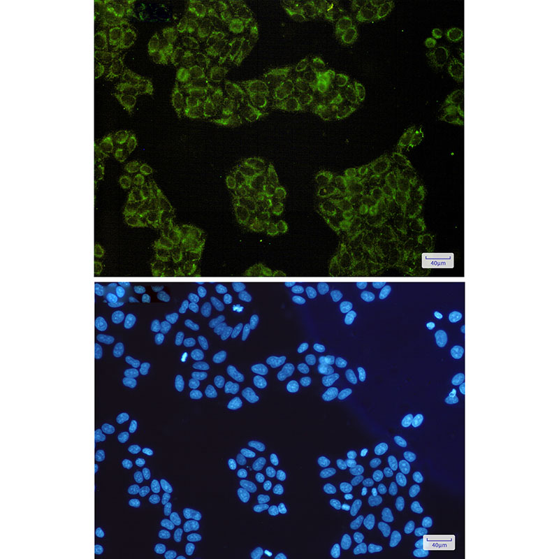SMAC Rabbit mAb ABZ1813