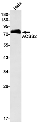 ACSS2 Rabbit mAb ABZ1814