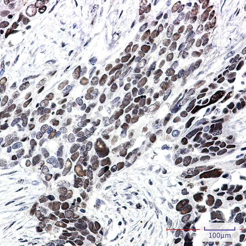 TCF4 Rabbit mAb ABZ1817