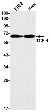 TCF4 Rabbit mAb ABZ1817