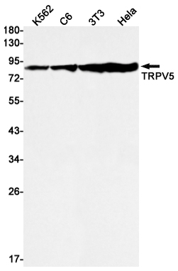 TrpV5 Rabbit mAb ABZ1818