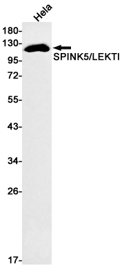 SPINK5 Rabbit mAb ABZ1819
