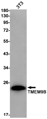 TMEM9B Rabbit mAb ABZ1820