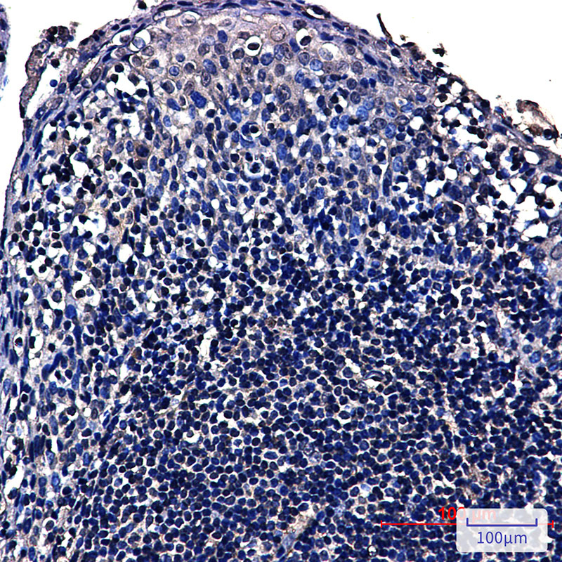 NOP10 Rabbit mAb ABZ1822