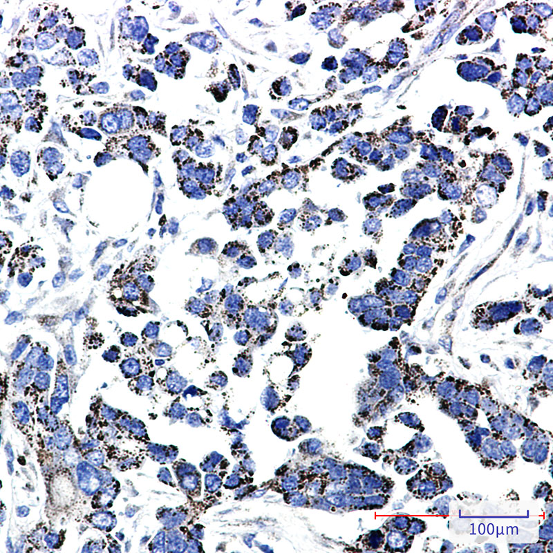 TXNRD2 Rabbit mAb ABZ1824