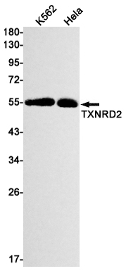 TXNRD2 Rabbit mAb ABZ1824