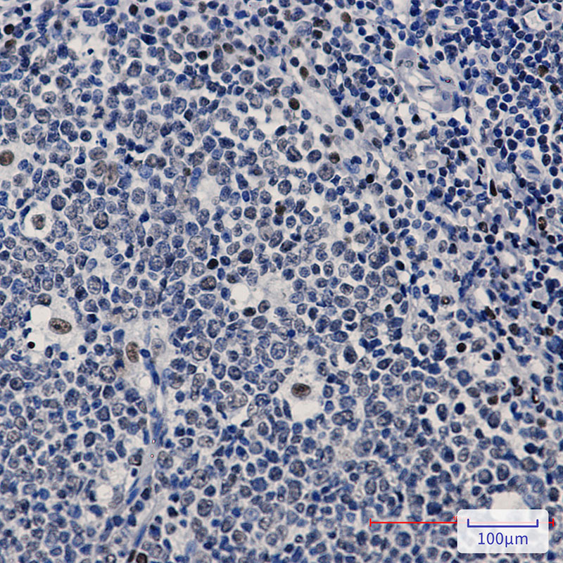 PREB Rabbit mAb ABZ1825