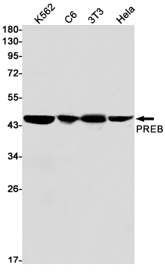 PREB Rabbit mAb ABZ1825