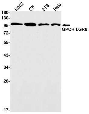 LGR6 Rabbit mAb ABZ1827