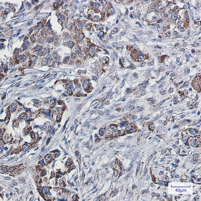 SEC61A Rabbit mAb ABZ1830