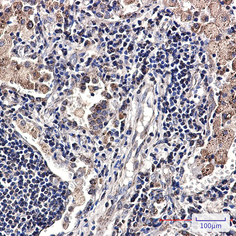 SMYD3 Rabbit mAb ABZ1833