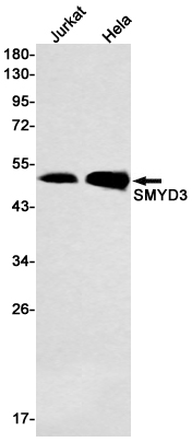 SMYD3 Rabbit mAb ABZ1833