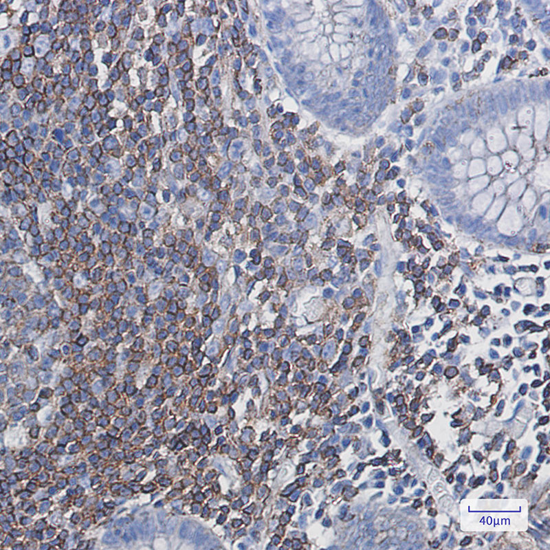 PHD3 Rabbit mAb ABZ1834