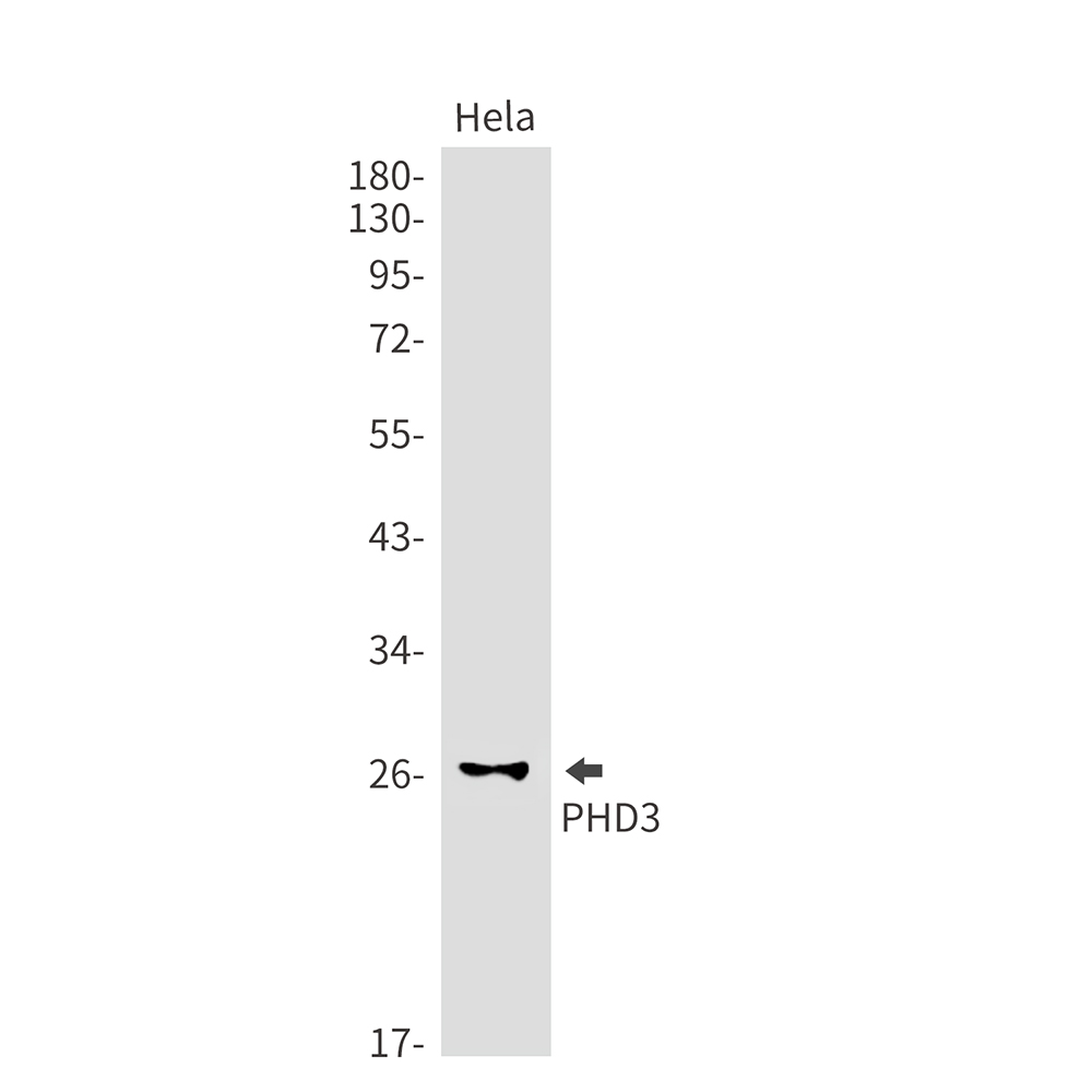 PHD3 Rabbit mAb ABZ1834