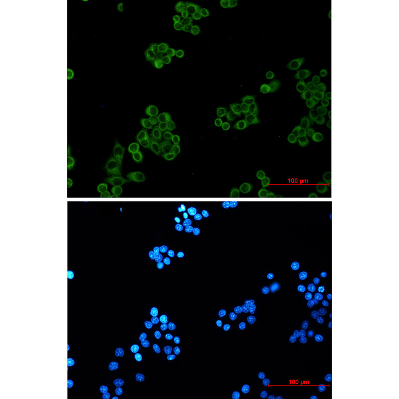EHD1 Rabbit mAb ABZ1836