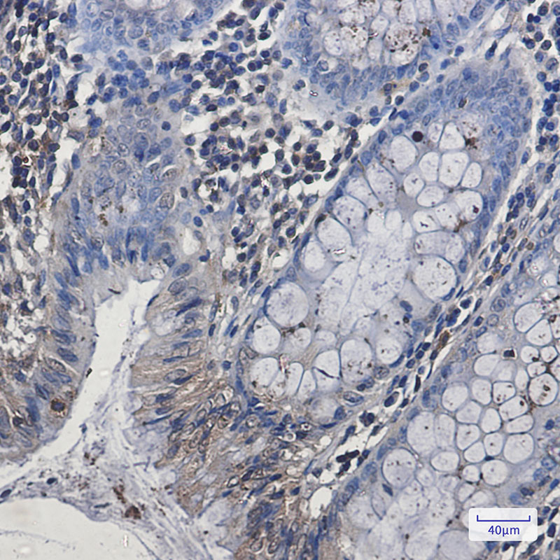 EHD1 Rabbit mAb ABZ1836