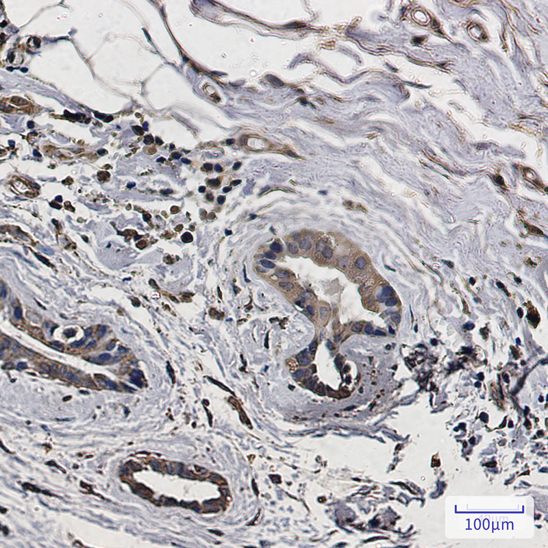 LC3A Rabbit mAb ABZ1837