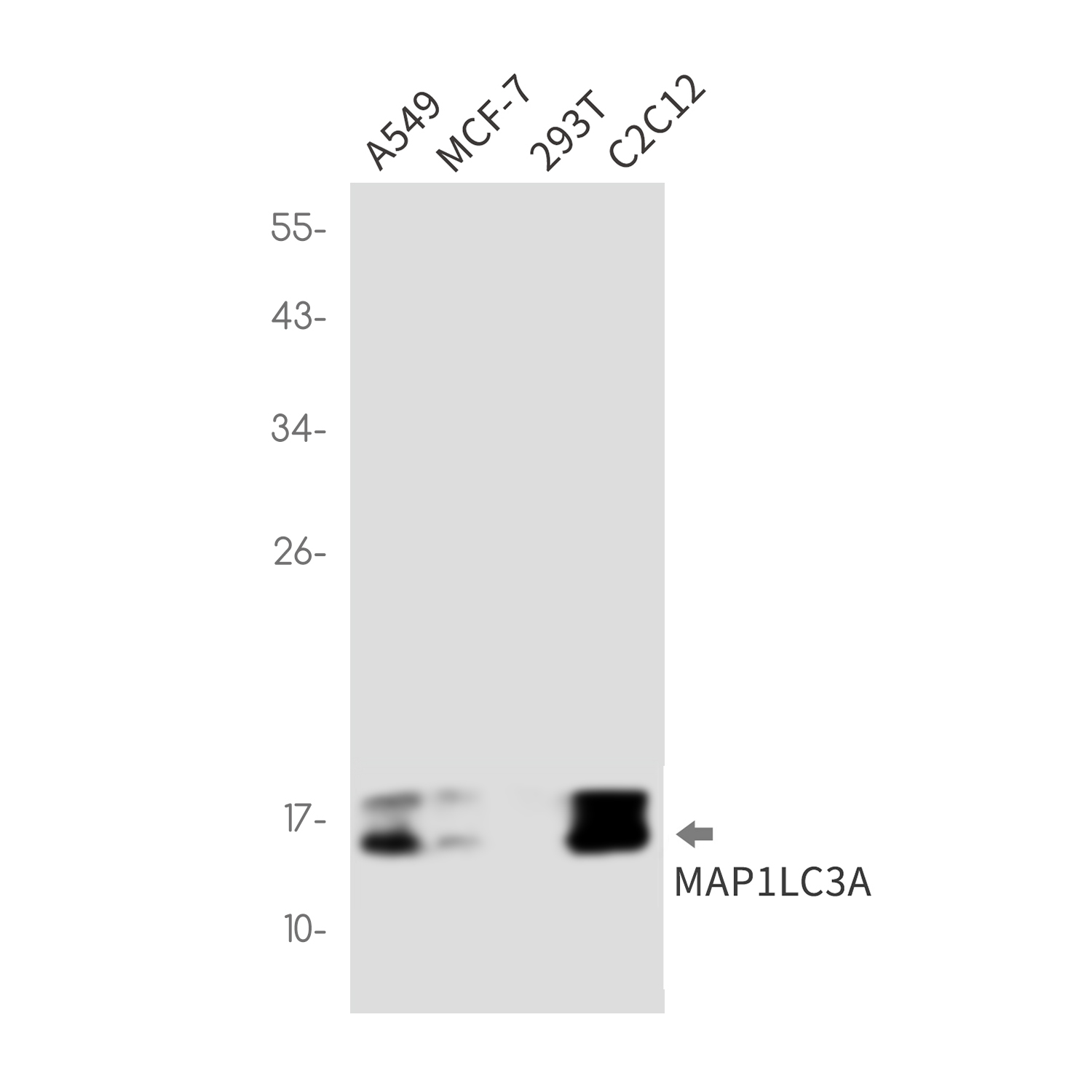 LC3A Rabbit mAb ABZ1838