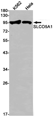 OATP5A1 Rabbit mAb ABZ1841