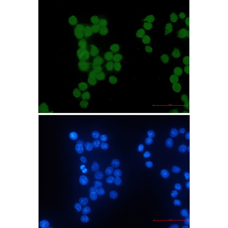 HIPK2 Rabbit mAb ABZ1842