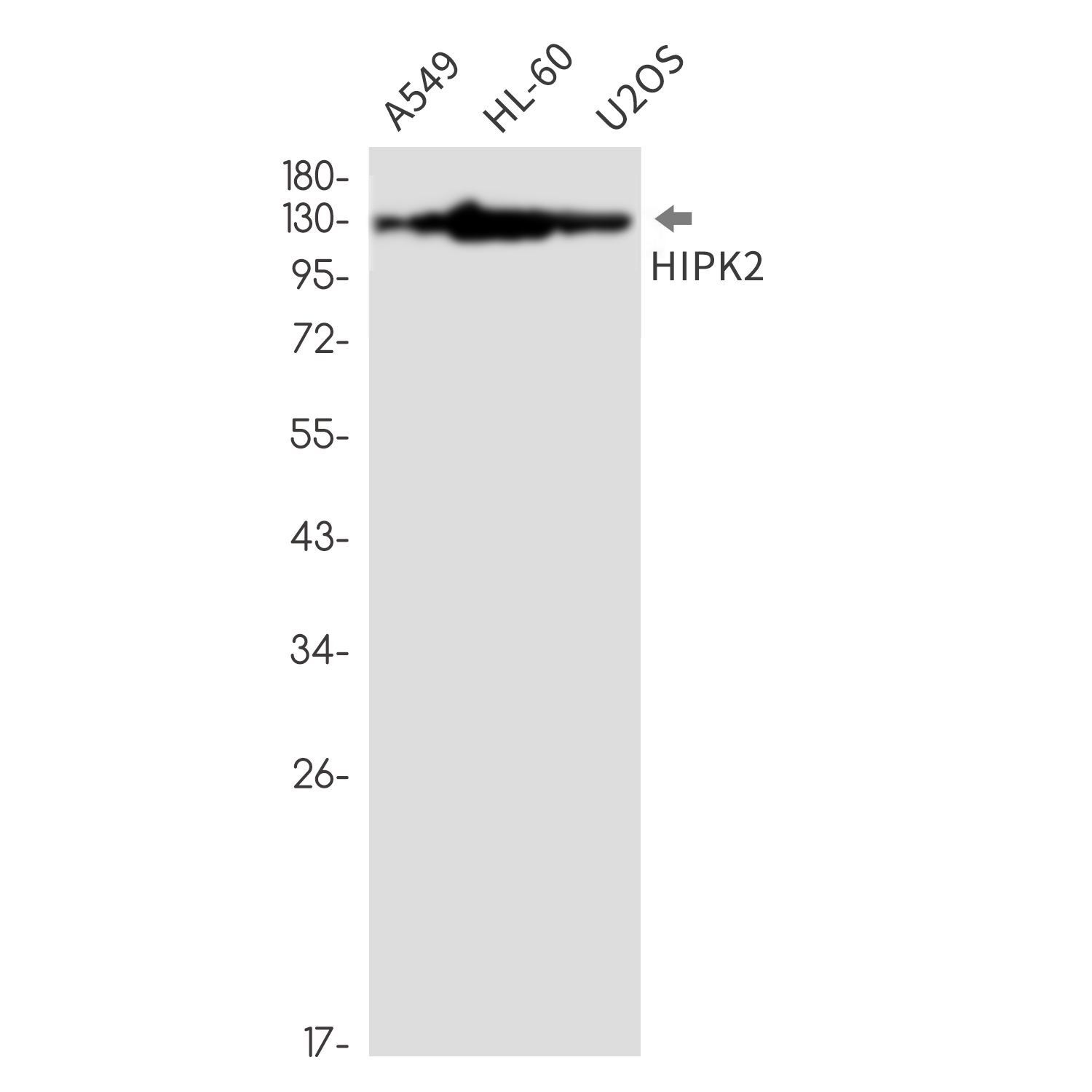 HIPK2 Rabbit mAb ABZ1842