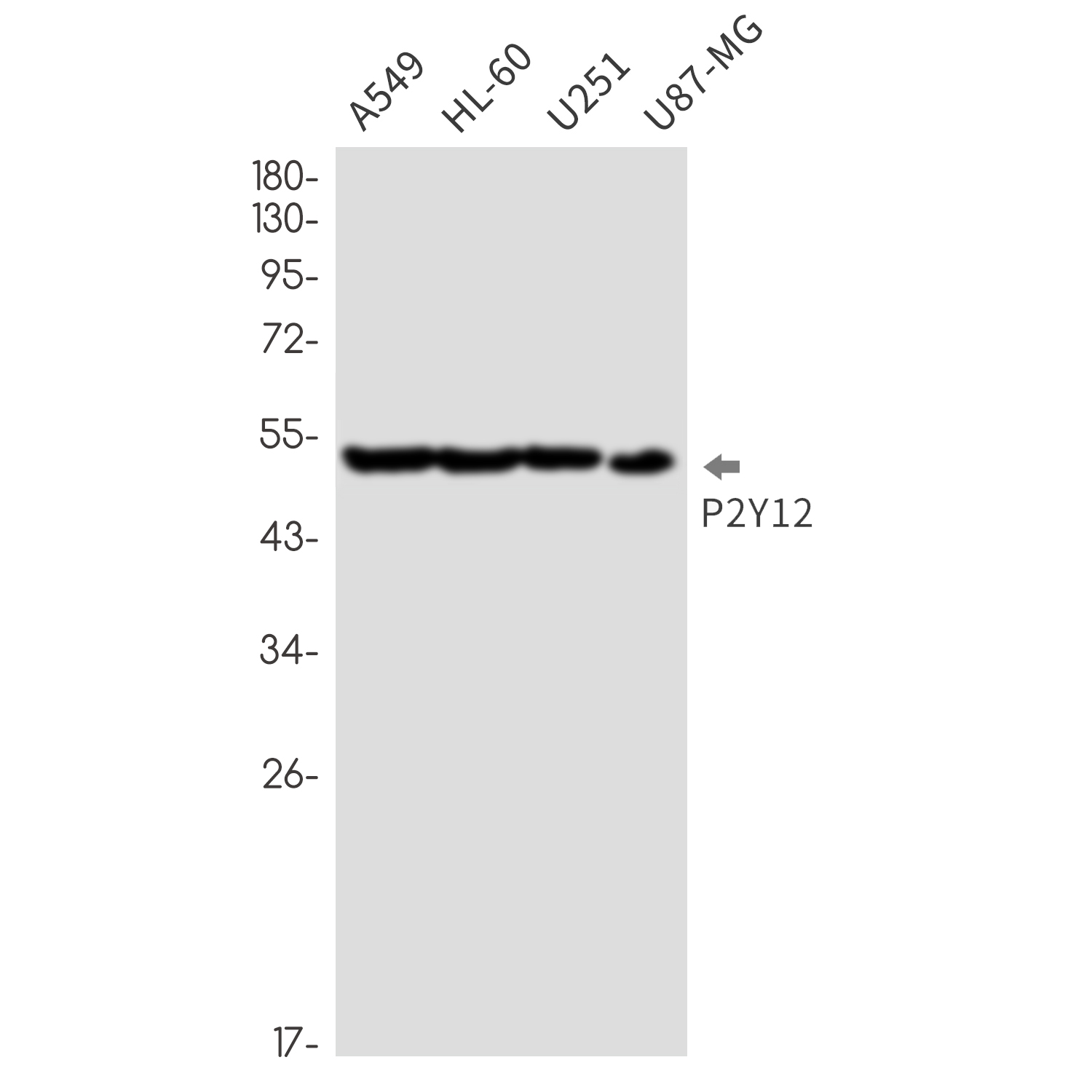 P2RY12 Rabbit mAb ABZ1844