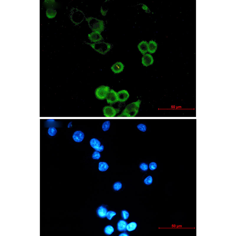 APG5L/ATG5 Rabbit mAb ABZ1845