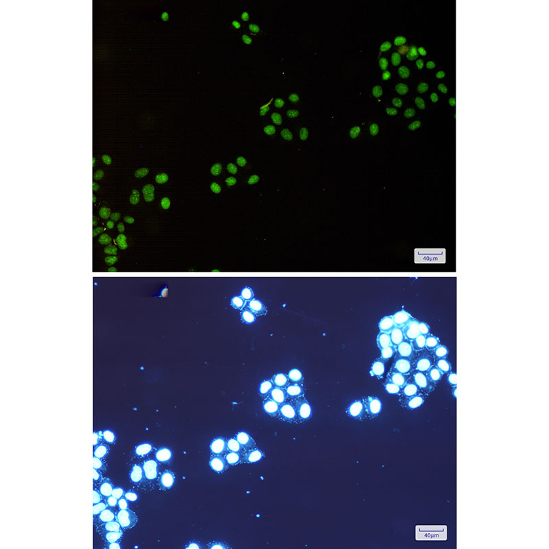 NAT10 Rabbit mAb ABZ1848