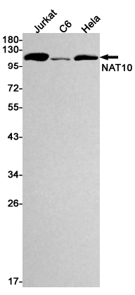 NAT10 Rabbit mAb ABZ1848