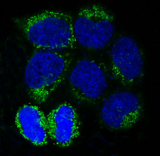LC3B Rabbit mAb ABZ1850