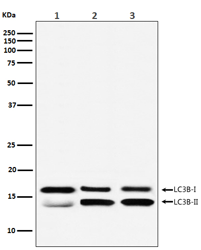 LC3B Rabbit mAb ABZ1850