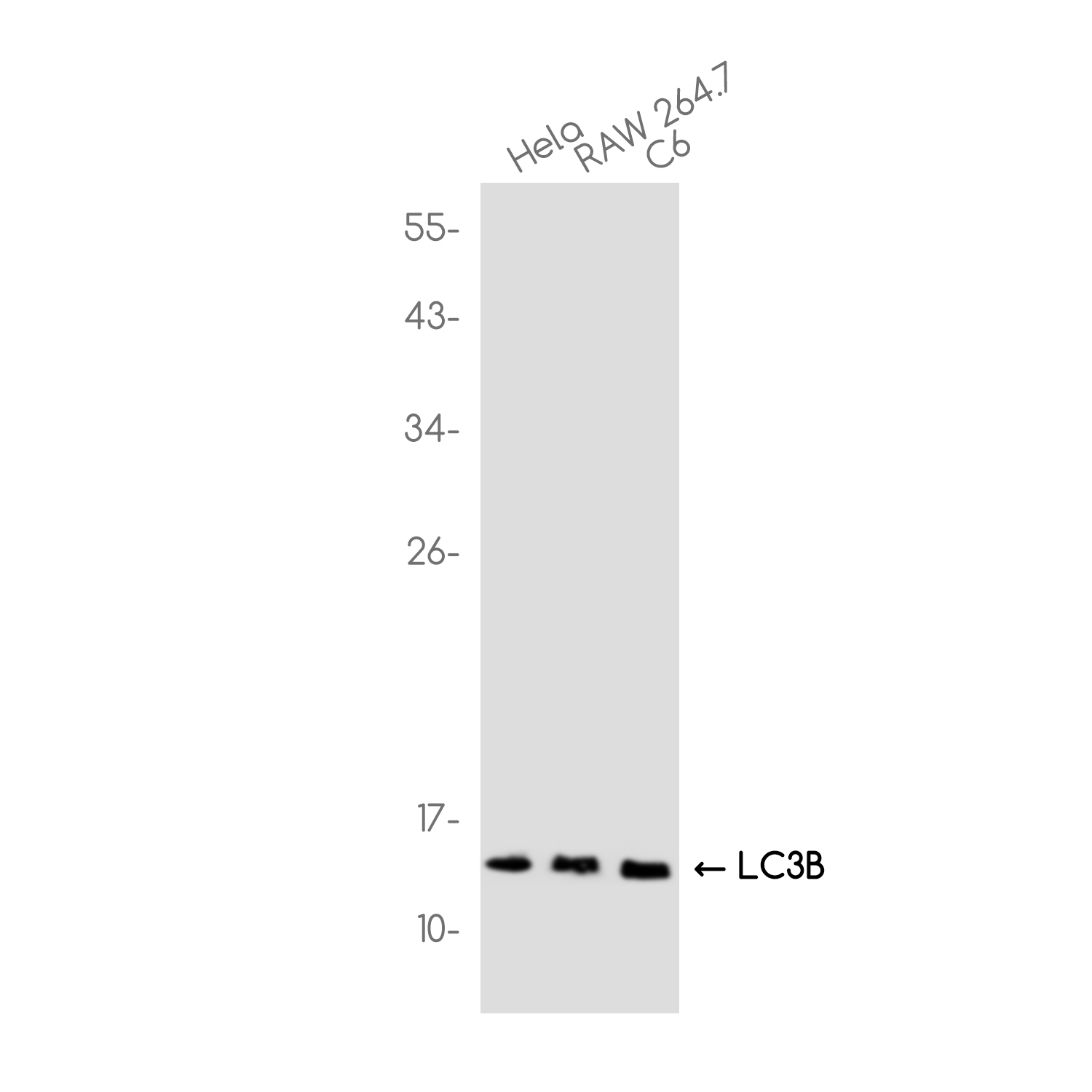LC3B Rabbit mAb ABZ1850