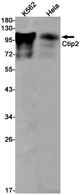 Ctip2 Rabbit mAb ABZ1852