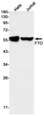 FTO Rabbit mAb ABZ1854