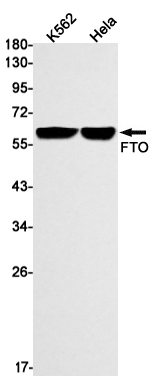 FTO Rabbit mAb ABZ1855