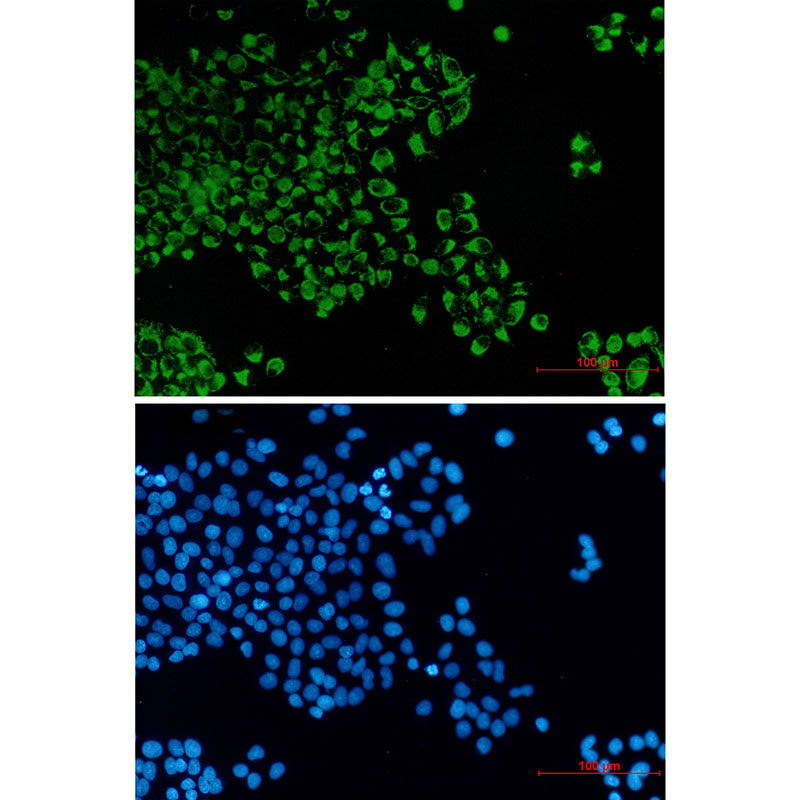 BCL2L14/BCLG Rabbit mAb ABZ1857