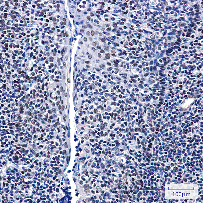 GTPBP4 Rabbit mAb ABZ1858