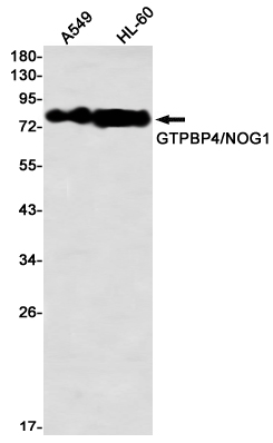 GTPBP4 Rabbit mAb ABZ1858