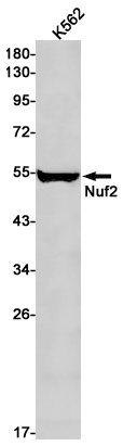 Nuf2 Rabbit mAb ABZ1859