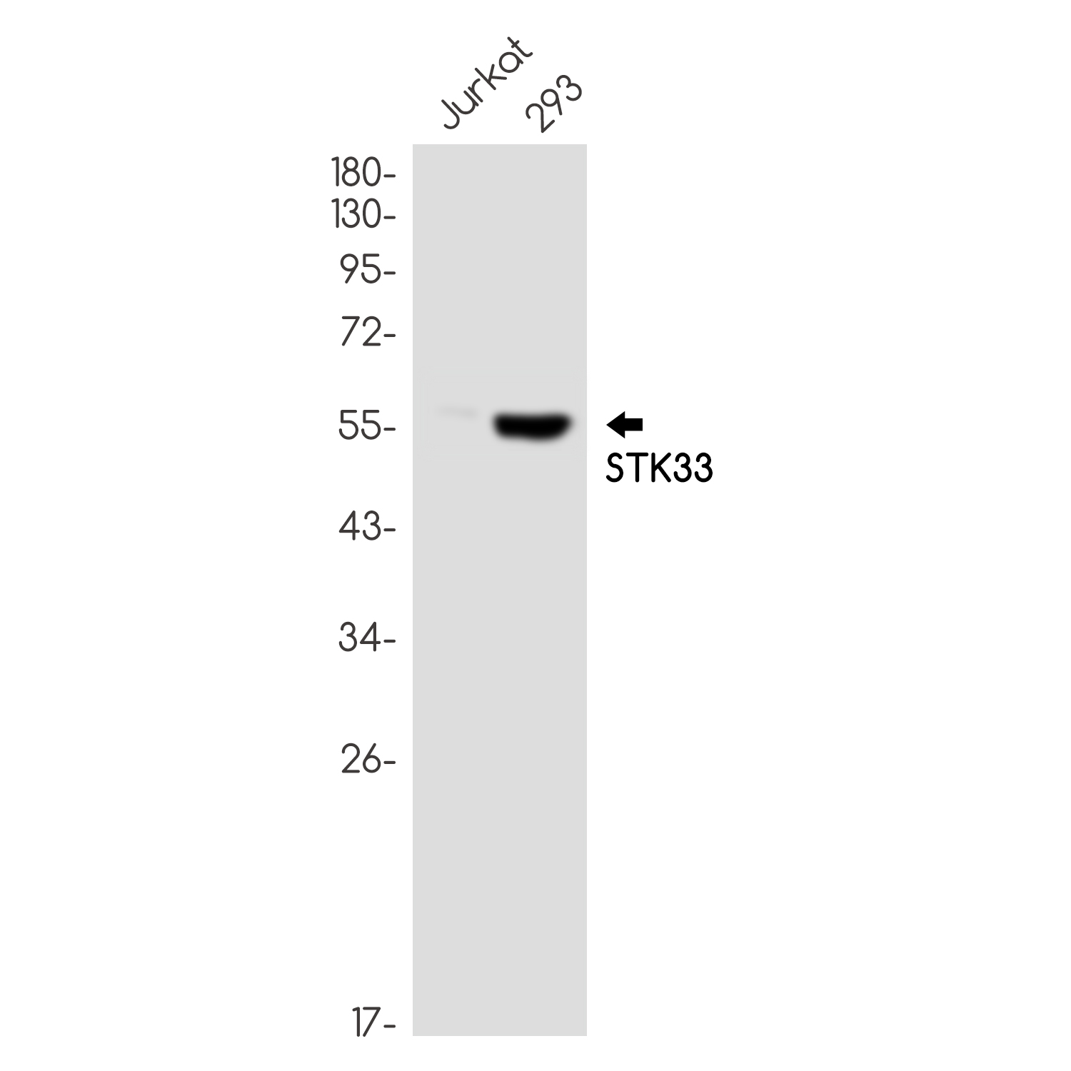 STK33 Rabbit mAb ABZ1860