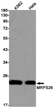 MRPS26 Rabbit mAb ABZ1861