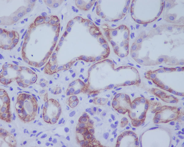 ACE2 Rabbit mAb ABZ1862