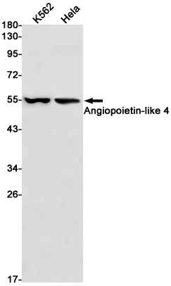 Angiopoietin-like 4/ANGPTL4 Rabbit mAb ABZ1863