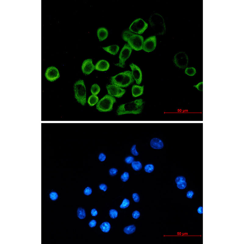 eIF2A Rabbit mAb ABZ1864
