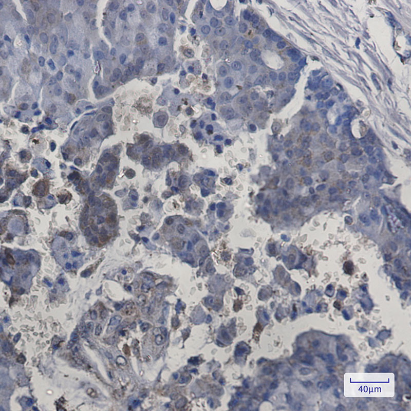 ITPA Rabbit mAb ABZ1865