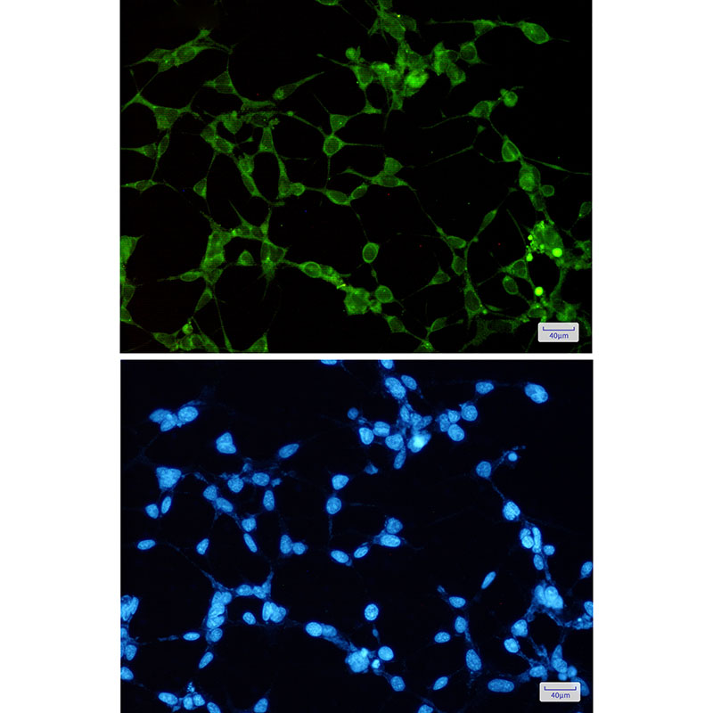 ORP1 Rabbit mAb ABZ1866