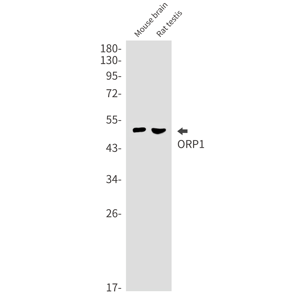ORP1 Rabbit mAb ABZ1866