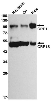 ORP1 Rabbit mAb ABZ1866