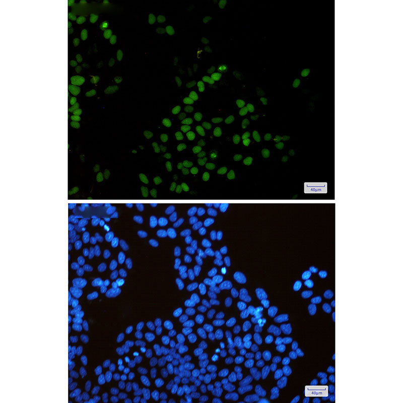 KIFC1 Rabbit mAb ABZ1868